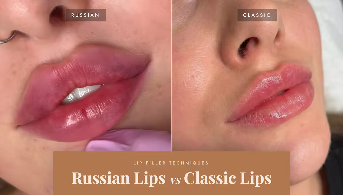 Russian lips vs classic lips comparison of shape, technique and results, House of Glam HQ Portsmouth