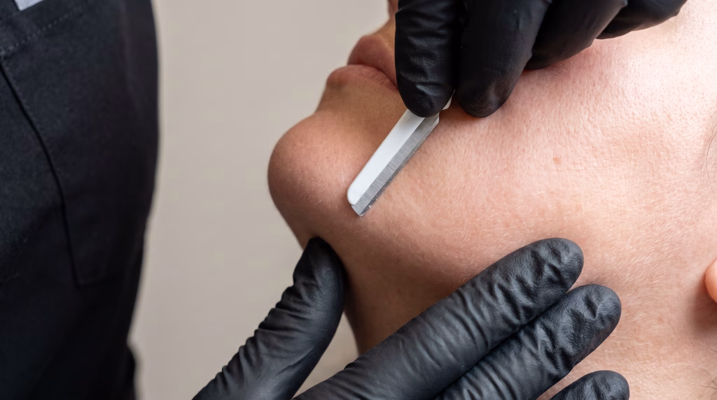 A sterile flat dermaplaning blade drawn at a shallow angle across taut cheek skin by a gloved hand