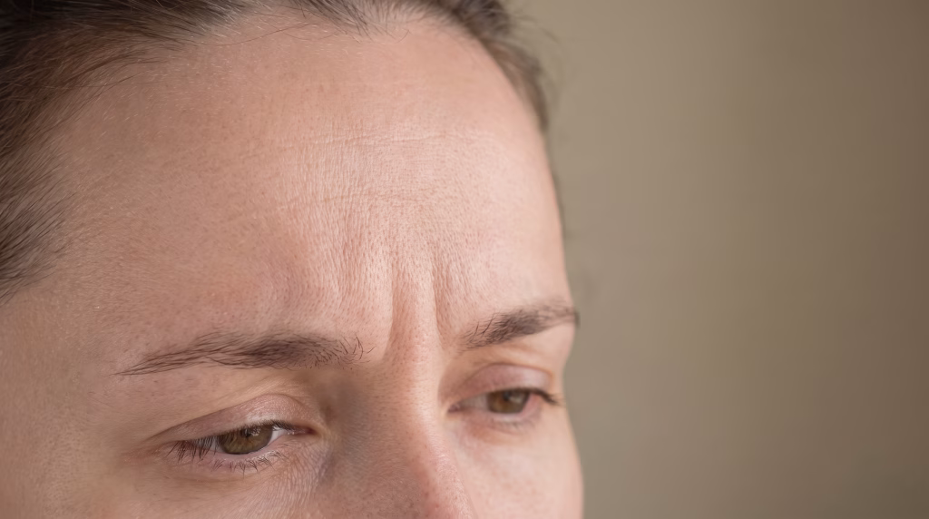 Close-up of a forehead with the frown and horizontal lines creased and active on bare skin