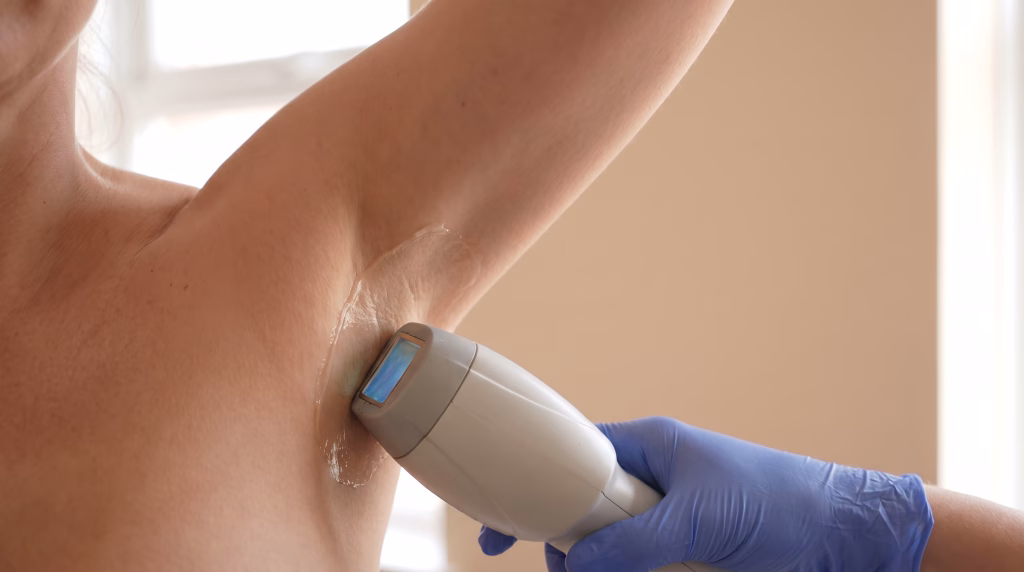 A laser hair removal handpiece with its cooling tip on a woman's underarm, cooling gel on the skin